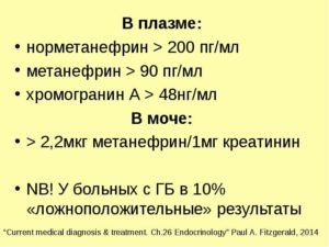 Метанефрины в моче