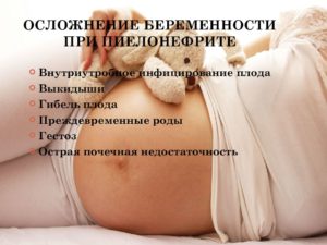 Можно ли беременеть при пиелонефрите