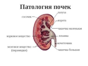 Патология почек что это