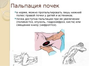 Перкуссия почек в норме
