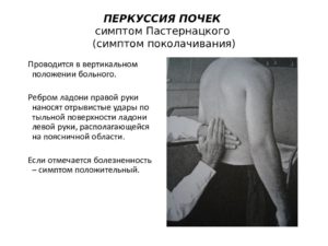 Перкуссия почек в норме