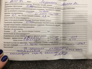 Пиелоэктазия почек у новорожденного слева