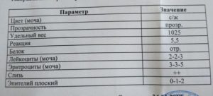 Слизь в моче 3 плюса что это значит