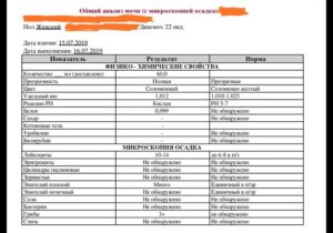 Слизь в моче 3 плюса что это значит