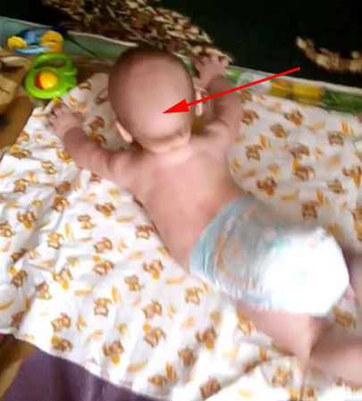 Залысина на затылке у малыша Димы
